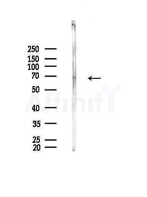 Phospho-PDPK1 (Tyr376) Antibody - Western blot analysis of lysates from Rat liver, using Phospho-PDPK1 (Tyr376) Antibody at 1/1000 dilution.