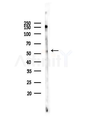 Phospho-CSK (Tyr304) Antibody - Western blot analysis of lysates from COLO205 cells(heat-shock treatment), using Phospho-CSK (Tyr304) Antibody at 1/1000 dilution.