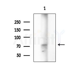 Phospho-DYRK1A/B (Tyr321/Tyr273) Antibody - Western blot analysis of extracts from Rat testis, using Phospho-DYRK1A/B (Tyr321/Tyr273) Antibody at 1/1000 dilution.
