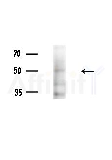 Phospho-DYRK2/4 (Tyr382/Tyr264) Antibody - Western blot analysis of extracts from B16F10-LUC cells(LPS,4h treatment), using Phospho-DYRK2/4 (Tyr382/Tyr264) Antibody at 1/1000 dilution.