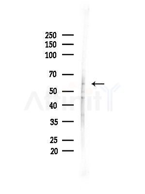 Phospho-DYRK2/4 (Tyr382/Tyr264) Antibody - Western blot analysis of lysates from B16F10-LUC cells(LPS,4h treatment), using Phospho-DYRK2/4 (Tyr382/Tyr264) Antibody at 1/1000 dilution.