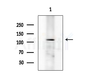 Phospho-ERK5 (Thr219+Tyr221) Antibody - Western blot analysis of extracts from EC304 cells, using Phospho-ERK5 (Thr219+Tyr221) Antibody at 1/1000 dilution.