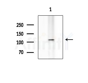 Phospho-ERK5 (Thr219+Tyr221) Antibody - Western blot analysis of extracts from HUVEC cells, using Phospho-ERK5 (Thr219+Tyr221) Antibody at 1/1000 dilution.