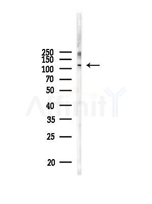 Phospho-ERK5 (Thr219+Tyr221) Antibody - Western blot analysis of lysates from HUVEC cells, using Phospho-ERK5 (Thr219+Tyr221) Antibody at 1/1000 dilution.