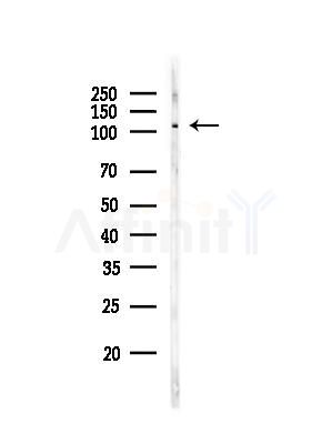 Phospho-ERK5 (Thr219+Tyr221) Antibody - Western blot analysis of lysates from EC304 cells, using Phospho-ERK5 (Thr219+Tyr221) Antibody at 1/1000 dilution.