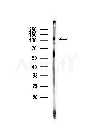 Phospho-FER (Tyr714) Antibody - Western blot analysis of lysates from HUVEC cells, using Phospho-FER (Tyr714) Antibody at 1/1000 dilution.