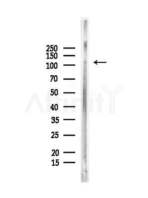 Phospho-Flt3 / CD135 (Tyr589) Antibody - Western blot analysis of lysates from Rat testis, using Phospho-Flt3 / CD135 (Tyr589) Antibody at 1/1000 dilution.