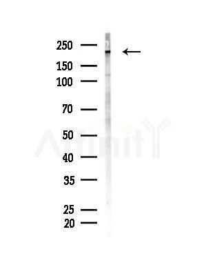 Phospho-GCN2 (Thr899) Antibody - Western blot analysis of lysates from LoVo cells(heat-shock,45min treatment), using Phospho-GCN2 (Thr899) Antibody at 1/1000 dilution.