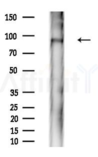 Phospho-IKK epsilon (Ser172) Antibody - Western blot analysis of extracts from Rat brain, using Phospho-IKK epsilon (Ser172) Antibody at 1/1000 dilution.
