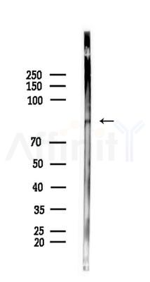 Phospho-IKK epsilon (Ser172) Antibody - Western blot analysis of lysates from Rat brain, using Phospho-IKK epsilon (Ser172) Antibody at 1/1000 dilution.