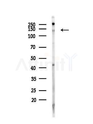 Phospho-c-Kit (Ser746) Antibody - Western blot analysis of lysates from A375 cells(heat-shock,45min treatment), using Phospho-c-Kit (Ser746) Antibody at 1/1000 dilution.