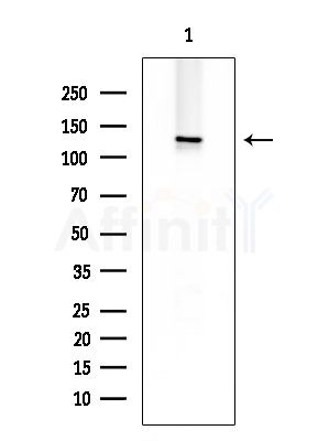 Phospho-LATS1/2 (Ser909/Ser872) Antibody - Western blot analysis of extracts from EC304 cells, using Phospho-LATS1/2 (Ser909/Ser872) Antibody at 1/1000 dilution.