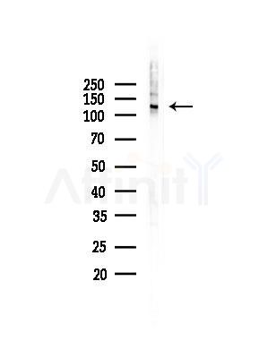 Phospho-LATS1/2 (Ser909/Ser872) Antibody - Western blot analysis of lysates from EC304 cells, using Phospho-LATS1/2 (Ser909/Ser872) Antibody at 1/1000 dilution.
