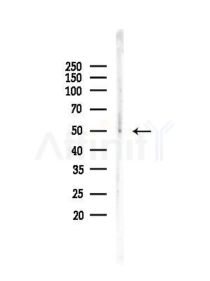 Phospho-MEK1/2 (Ser212/Ser216) Antibody - Western blot analysis of lysates from HUVEC cells, using Phospho-MEK1/2 (Ser212/Ser216) Antibody at 1/1000 dilution.