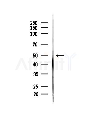 Phospho-MEK5 (Thr315) Antibody - Western blot analysis of lysates from HUVEC cells(starvation,24h treatment), using Phospho-MEK5 (Thr315) Antibody at 1/1000 dilution.
