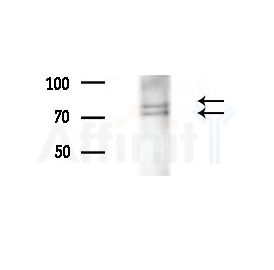 Phospho-MSK2 (Ser196) Antibody - Western blot analysis of extracts from A375 cells(heat-shock,45min treatment), using Phospho-MSK2 (Ser196) Antibody at 1/1000 dilution.