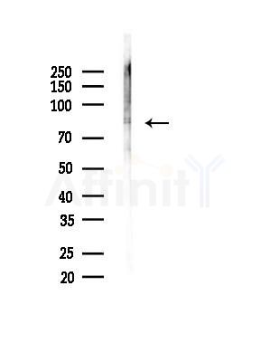 Phospho-MSK2 (Ser196) Antibody - Western blot analysis of lysates from A375 cells(heat-shock,45min treatment), using Phospho-MSK2 (Ser196) Antibody at 1/1000 dilution.