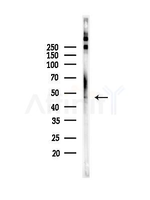 Phospho-MST3 (Thr18) Antibody - Western blot analysis of lysates from HUVEC cells, using Phospho-MST3 (Thr18) Antibody at 1/1000 dilution.