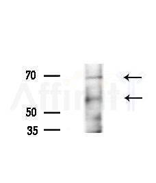 Phospho-NuaK1 (Ser600) Antibody - Western blot analysis of extracts from Rat brain, using Phospho-NuaK1 (Ser600) Antibody at 1/1000 dilution.