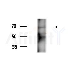 Phospho-NuaK1 (Ser600) Antibody - Western blot analysis of extracts from A375 cells(heat-shock,45min treatment), using Phospho-NuaK1 (Ser600) Antibody at 1/1000 dilution.