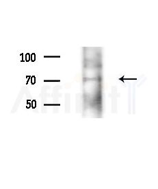 Phospho-NuaK1 (Ser600) Antibody - Western blot analysis of extracts from Mouse liver, using Phospho-NuaK1 (Ser600) Antibody at 1/1000 dilution.