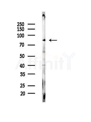 Phospho-NuaK1 (Ser600) Antibody - Western blot analysis of lysates from Mouse liver, using Phospho-NuaK1 (Ser600) Antibody at 1/1000 dilution.