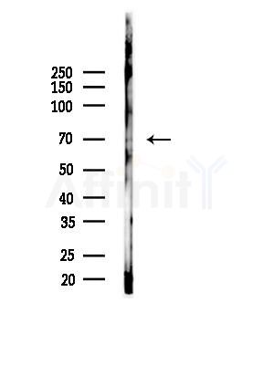 Phospho-NuaK1 (Ser600) Antibody - Western blot analysis of lysates from A375 cells(heat-shock,45min treatment), using Phospho-NuaK1 (Ser600) Antibody at 1/1000 dilution.