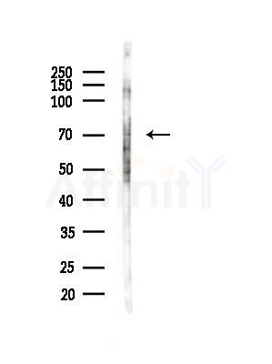 Phospho-NuaK1 (Ser600) Antibody - Western blot analysis of lysates from Rat brain, using Phospho-NuaK1 (Ser600) Antibody at 1/1000 dilution.