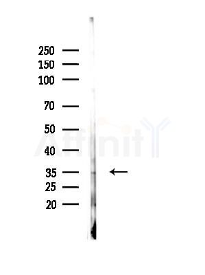 Phospho-p38 gamma/delta (Tyr185/Tyr182) Antibody - Western blot analysis of lysates from EC304 cells(heat-shock,45min treatment), using Phospho-p38 gamma/delta (Tyr185/Tyr182) Antibody at 1/1000 dilution.