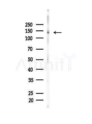 Phospho-SIK1(T182)/SIK2(T175)/SIK3(T221) Antibody - Western blot analysis of lysates from Mouse brain, using Phospho-SIK1(T182)/SIK2(T175)/SIK3(T221) Antibody at 1/1000 dilution.