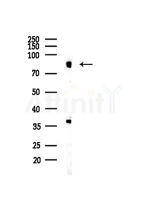 Phospho-TGFBR2 (Tyr284) Antibody - Western blot analysis of lysates from Rat brain, using Phospho-TGFBR2 (Tyr284) Antibody at 1/1000 dilution.