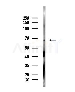 Phospho-FRS2 (Tyr196) Antibody - Western blot analysis of lysates from A375 cells(starvation treatment), using Phospho-FRS2 (Tyr196) Antibody at 1/1000 dilution.