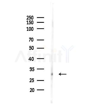 Phospho-LAT (Tyr161) Antibody - Western blot analysis of lysates from MDA-MB-231 cells, using Phospho-LAT (Tyr161) Antibody at 1/1000 dilution.