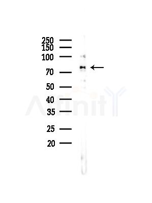 Phospho-eIF2B epsilon (Ser540) Antibody - Western blot analysis of lysates from COLO205 cells(UV,30min treatment), using Phospho-eIF2B epsilon (Ser540) Antibody at 1/1000 dilution.