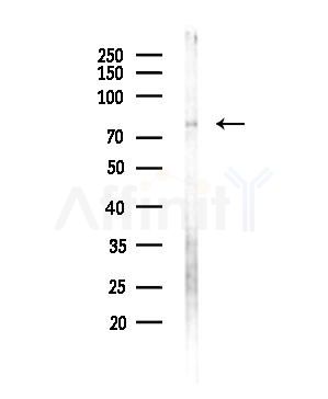 Phospho-eIF2B epsilon (Ser540) Antibody - Western blot analysis of lysates from MDA-MB-231 cells, using Phospho-eIF2B epsilon (Ser540) Antibody at 1/1000 dilution.