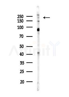 Phospho-BRCA1 (Ser1497) Antibody - Western blot analysis of lysates from Hela cells(heat-shock,45min treatment), using Phospho-BRCA1 (Ser1497) Antibody at 1/1000 dilution.