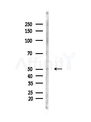 Phospho-Retinoic Acid Receptor  alpha/beta (Ser96) Antibody - Western blot analysis of lysates from LoVo cells(heat-shock,45min treatment), using Phospho-Retinoic Acid Receptor  alpha/beta (Ser96) Antibody at 1/1000 dilution.
