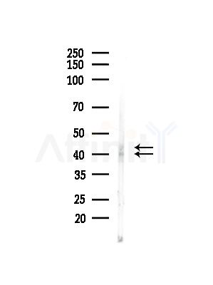 Phospho-ERK1/2 (Thr202+Tyr204/Thr185+Tyr187) Antibody - Western blot analysis of lysates from B16F10-LUC cells(starvation,24h treatment), using Phospho-ERK1/2 (Thr202+Tyr204/Thr185+Tyr187) Antibody at 1/1000 dilution.