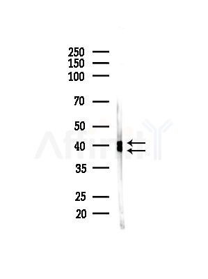 Phospho-ERK1/2 (Thr202+Tyr204/Thr185+Tyr187) Antibody - Western blot analysis of lysates from HUVEC cells(starvation,24h treatment), using Phospho-ERK1/2 (Thr202+Tyr204/Thr185+Tyr187) Antibody at 1/1000 dilution.