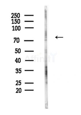 Phospho-eIF2B epsilon (Ser525) Antibody - Western blot analysis of lysates from Hela cells(LPS,4h treatment), using Phospho-eIF2B epsilon (Ser525) Antibody at 1/1000 dilution.