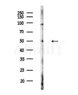 Phospho-RXR alpha (Ser260) Antibody - Western blot analysis of lysates from Hela cells(heat-shock,45min treatment), using Phospho-RXR alpha (Ser260) Antibody at 1/1000 dilution.