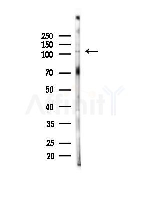 Phospho-AR (Tyr269) Antibody - Western blot analysis of lysates from PC12 cells(heat-shock,45min treatment), using Phospho-AR (Tyr269) Antibody at 1/1000 dilution.