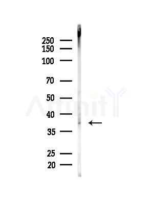 Phospho-AMPK beta 1 (Ser108) Antibody - Western blot analysis of lysates from Mouse brain, using Phospho-AMPK beta 1 (Ser108) Antibody at 1/1000 dilution.