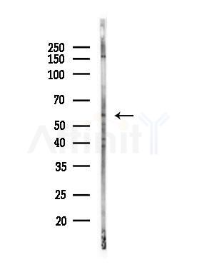 Phospho-APLF (Ser116) Antibody - Western blot analysis of lysates from PC12 cells(LPS, 4h treatment), using Phospho-APLF (Ser116) Antibody at 1/1000 dilution.