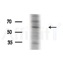 Phospho-BORA (Ser497) Antibody - Western blot analysis of extracts from A375 cells(starvation,24h treatment), using Phospho-BORA (Ser497) Antibody at 1/1000 dilution.
