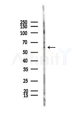 Phospho-BORA (Ser497) Antibody - Western blot analysis of lysates from A375 cells(starvation,24h treatment), using Phospho-BORA (Ser497) Antibody at 1/1000 dilution.