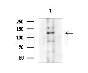 Phospho-CdGAP (Thr789) Antibody - Western blot analysis of extracts from COLO205 cells(heat-shock treatment), using Phospho-CdGAP (Thr789) Antibody at 1/1000 dilution.