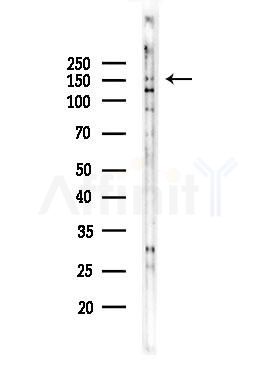 Phospho-CdGAP (Thr789) Antibody - Western blot analysis of lysates from COLO205 cells(heat-shock,45min treatment), using Phospho-CdGAP (Thr789) Antibody at 1/1000 dilution.