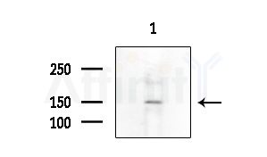 Phospho-Claspin (Ser30) Antibody - Western blot analysis of extracts from COLO205 cells(heat-shock treatment), using Phospho-Claspin (Ser30) Antibody at 1/1000 dilution.