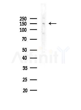 Phospho-Claspin (Ser30) Antibody - Western blot analysis of lysates from COLO205 cells(heat-shock,45min treatment), using Phospho-Claspin (Ser30) Antibody at 1/1000 dilution.